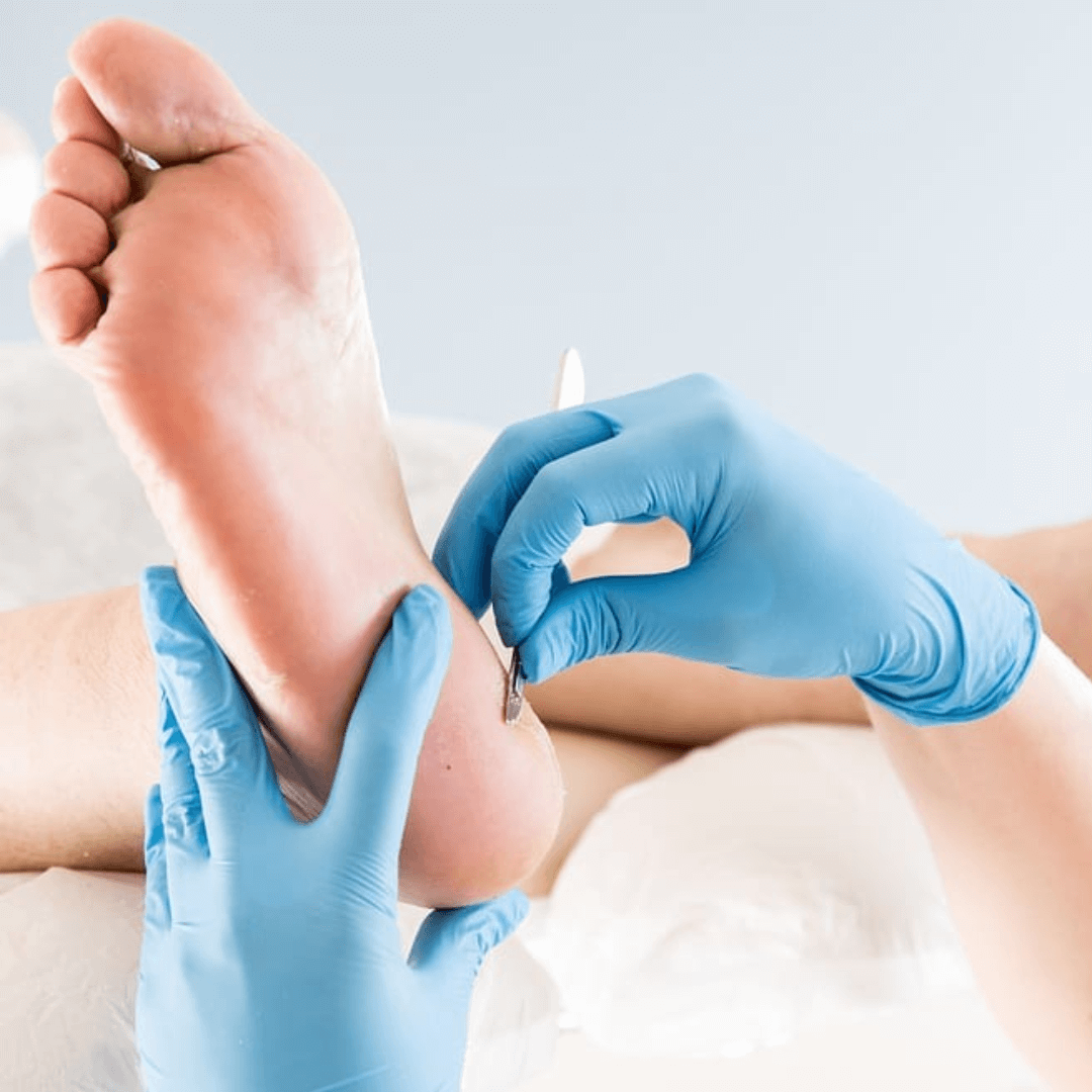 Medical pedicure