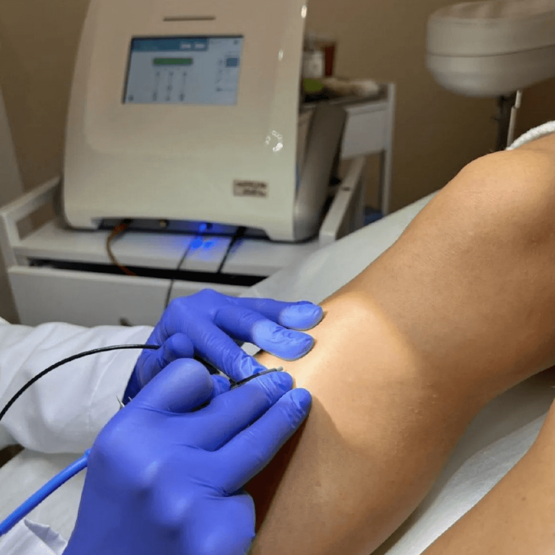 Electrolysis hair removal