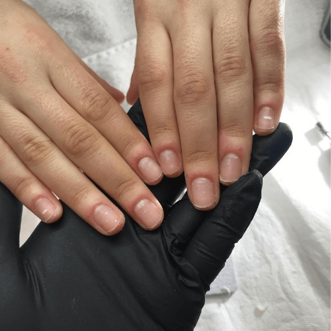 How to Remove Acrylic Nails With Oil