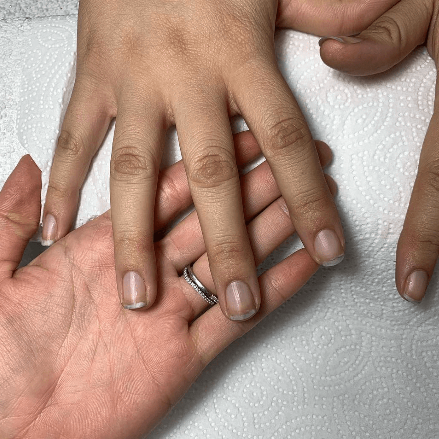 Tips for Healthy Nail Care After Removal