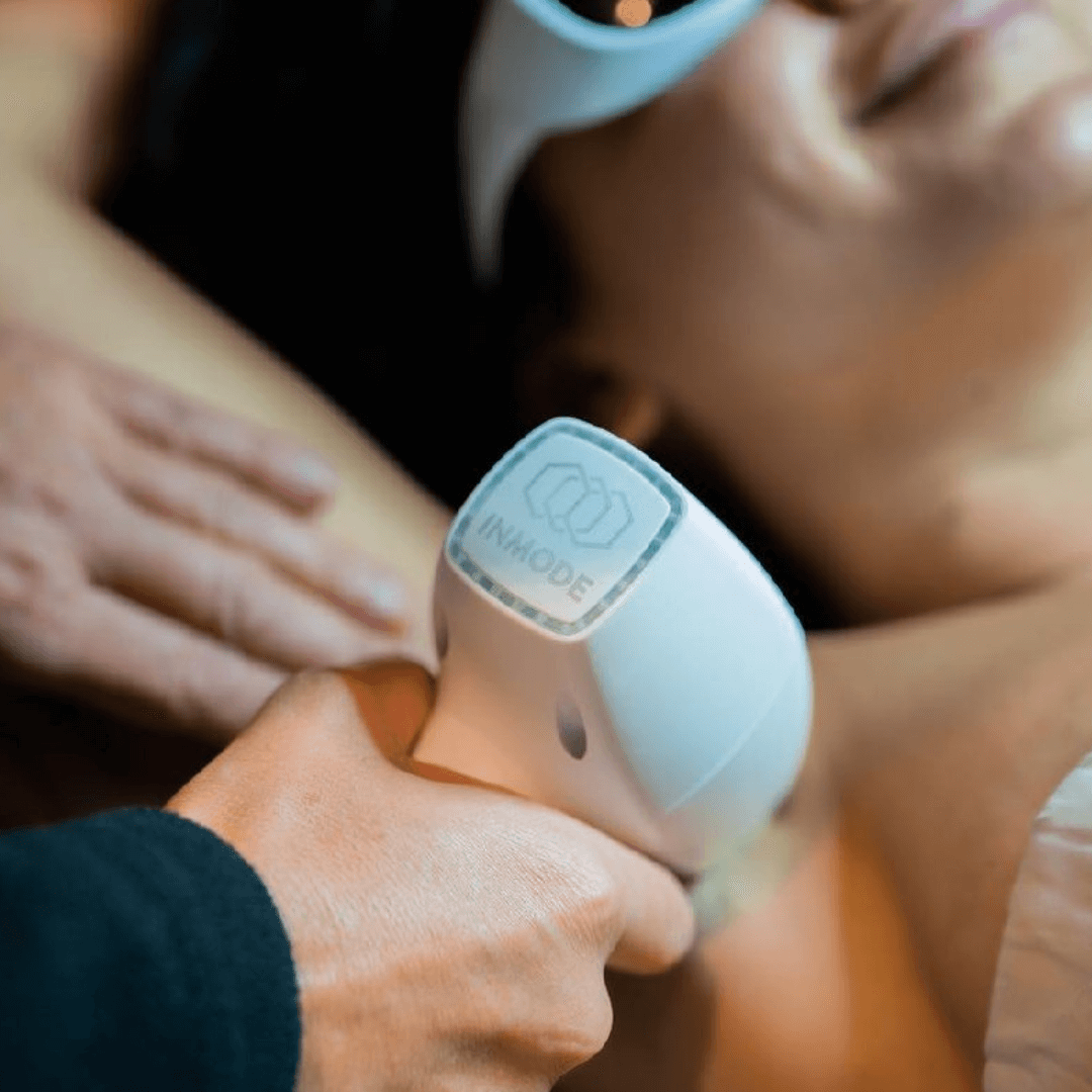 Laser hair removal