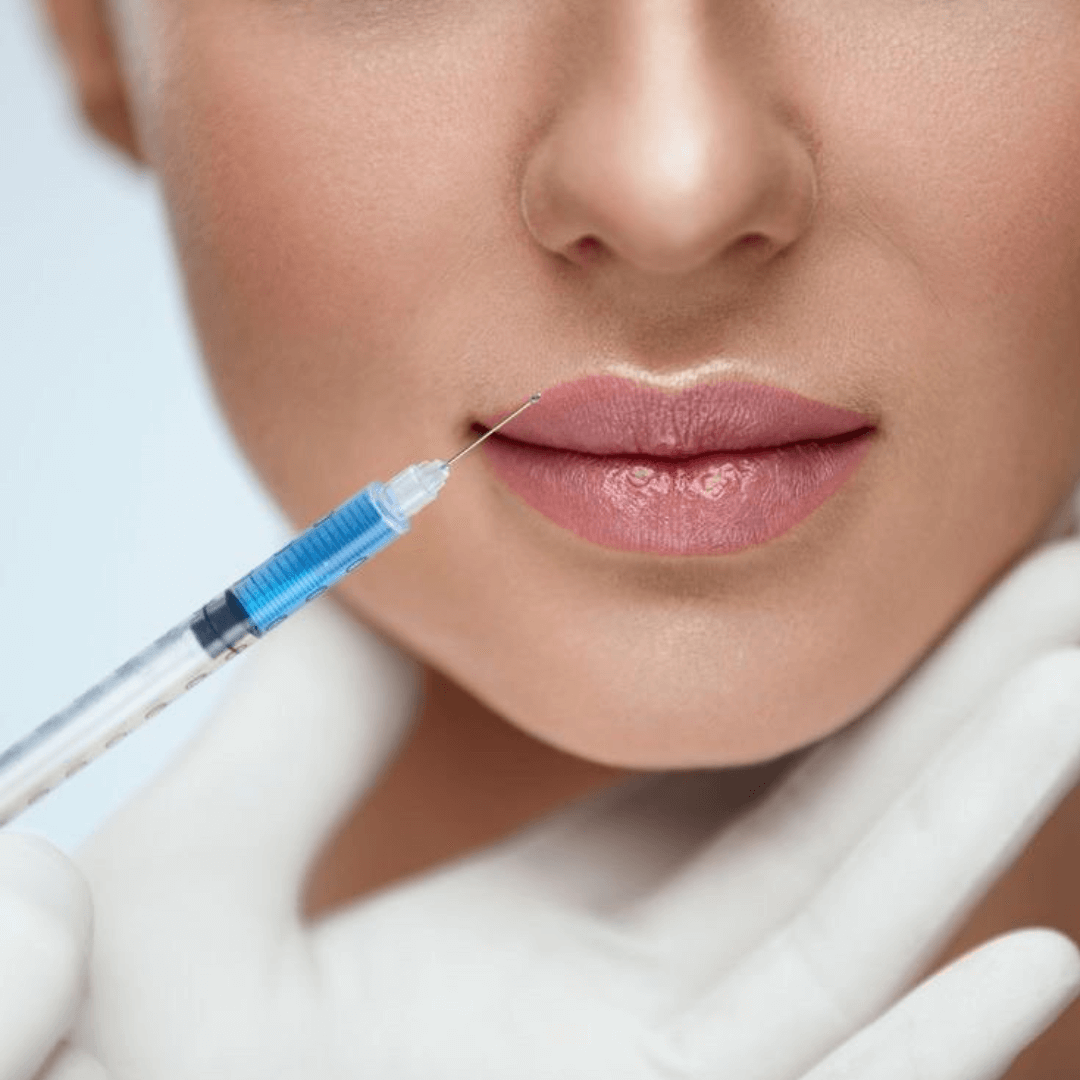 lip-augmentation-lip-fillers